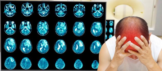 Cauze și diagnostic al edemului cerebral