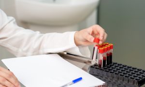 Importanța repetării analizelor de sânge