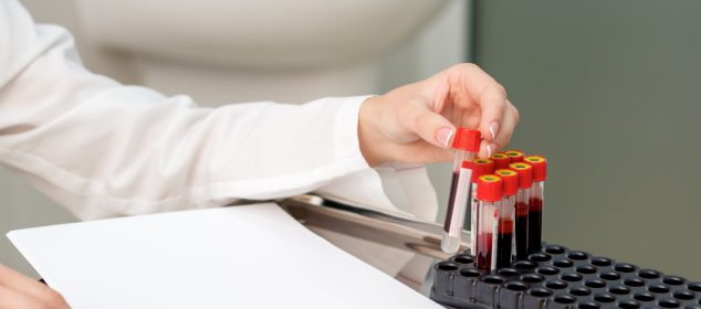 Importanța repetării analizelor de sânge